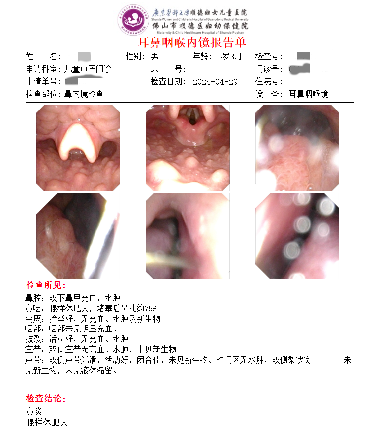 急！5岁孩子腺样体肥大堵塞鼻孔90%，一定要做手术吗？