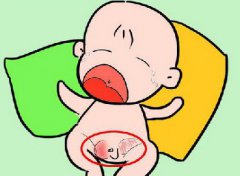 医生提醒：小儿疝气需尽早手术莫耽误
