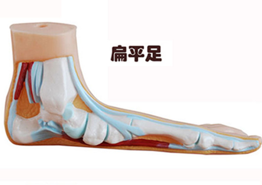 膝关节、颈椎疼痛？或是扁平足引起