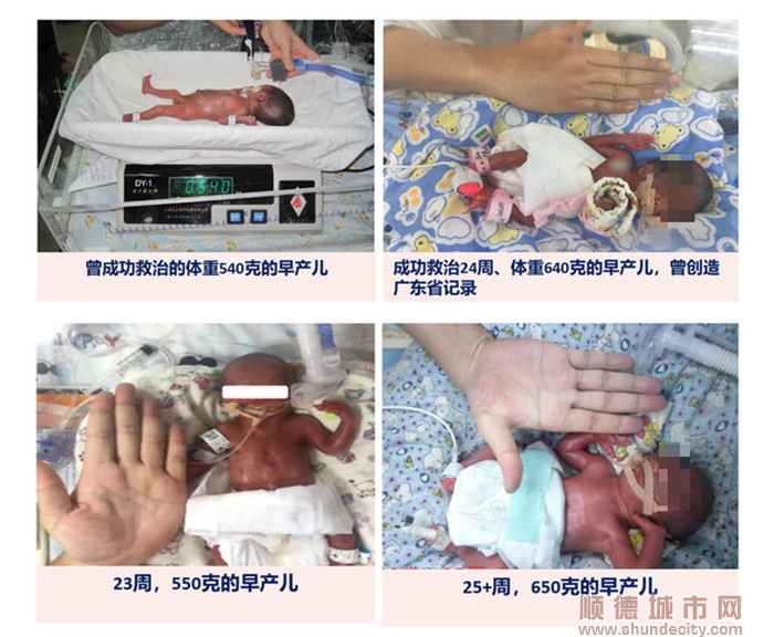 医院成功救治多个极低体重早产儿.png