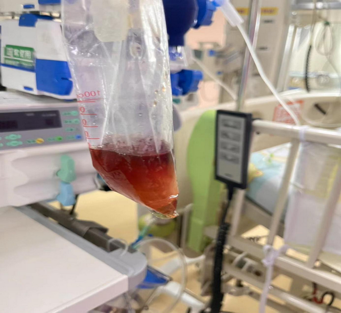 吃了一包零食，5岁娃进了ICU！这个病很多家长不知道