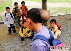 10岁男孩头顶10厘米大瘤，贫困挡着治疗路